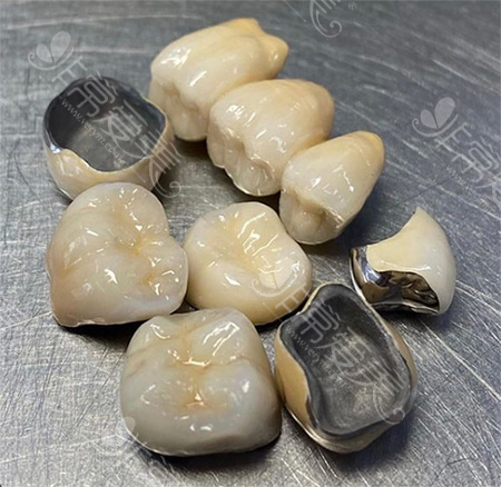 贵金属镶牙齿(贵金属镶牙齿好吗)