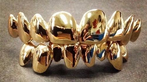 贵金属镶牙齿(镶金属牙多少钱一颗)
